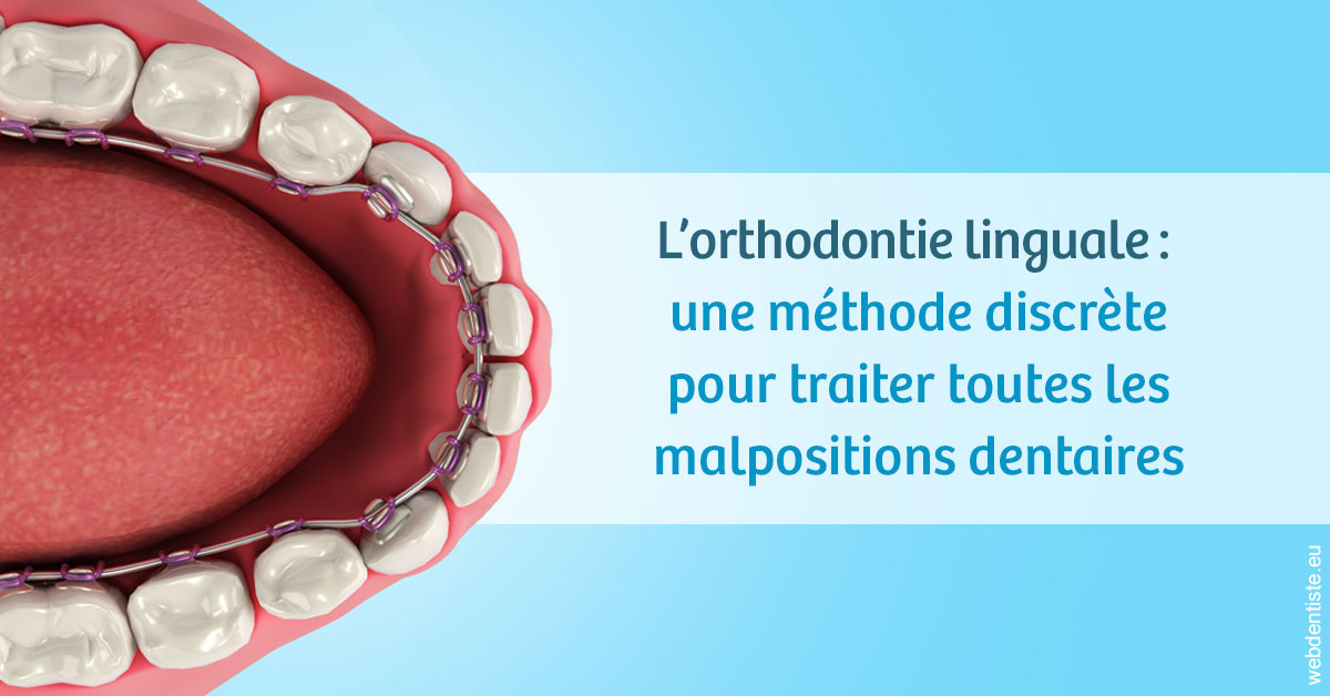 https://dr-estrabol-nicolas.chirurgiens-dentistes.fr/L'orthodontie linguale 1