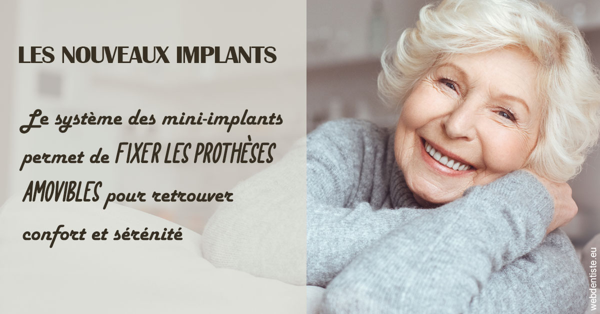 https://dr-estrabol-nicolas.chirurgiens-dentistes.fr/Les nouveaux implants 1