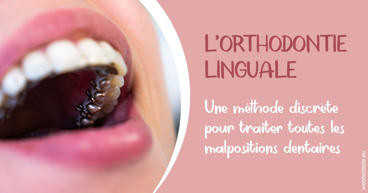 https://dr-estrabol-nicolas.chirurgiens-dentistes.fr/L'orthodontie linguale 2