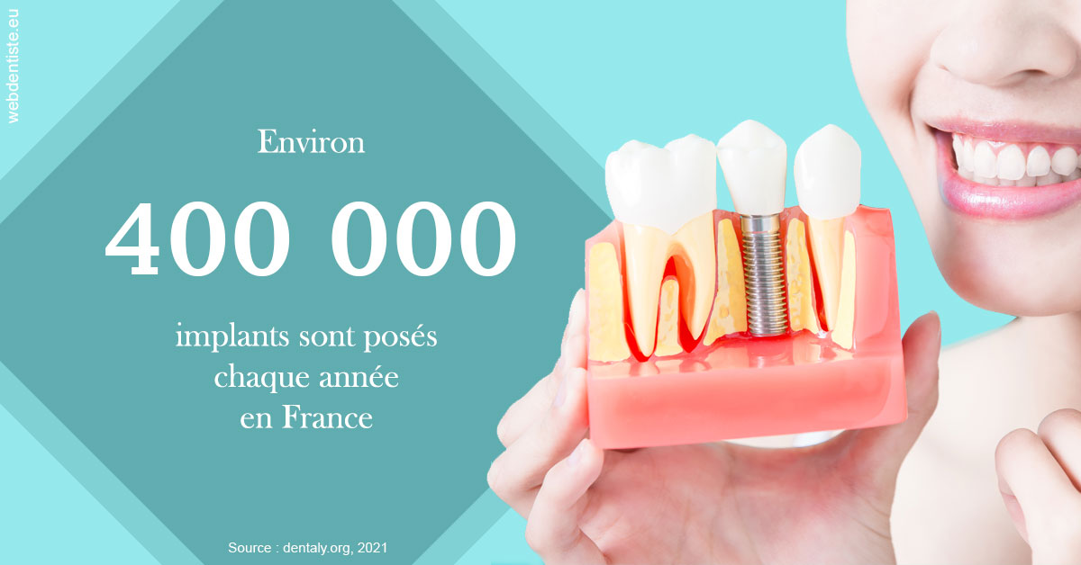 https://dr-estrabol-nicolas.chirurgiens-dentistes.fr/Pose d'implants en France 2